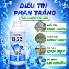 B52 Điều trị phân trắng