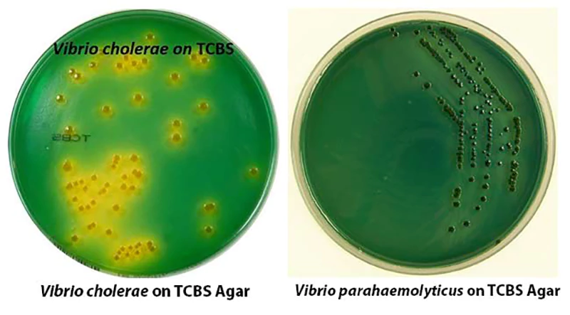 Kiểm tra khuẩn Vibrio parahaemolyticus