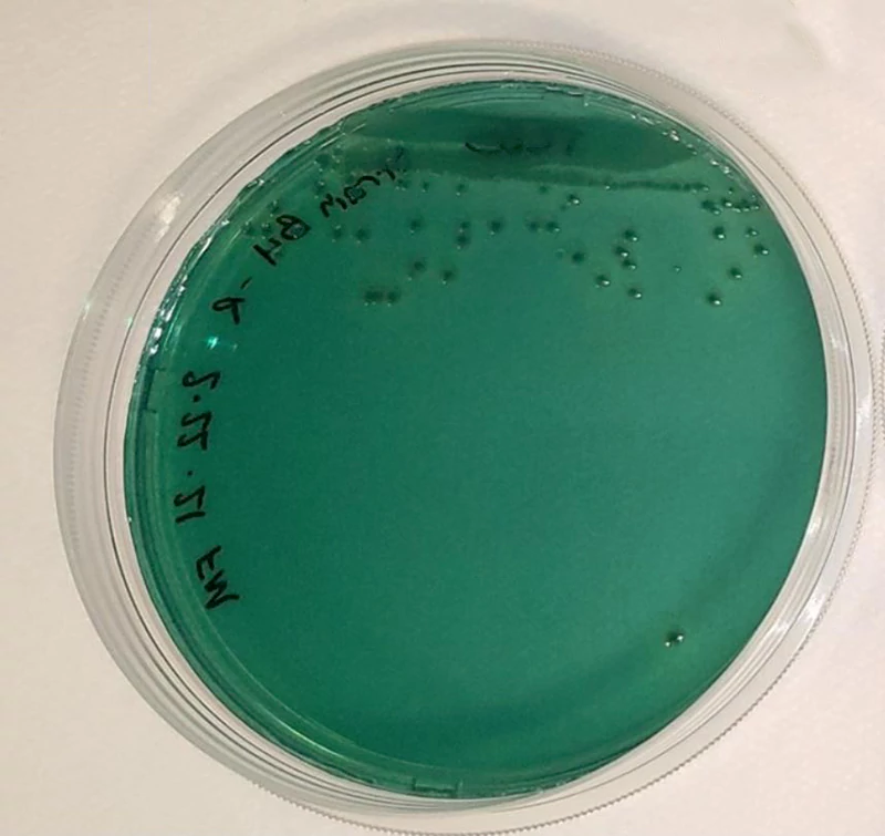 Test Vibrio parahaemolyticus trên đĩa thạch TCBS Test Vibrio parahaemolyticus trên đĩa thạch TCBS