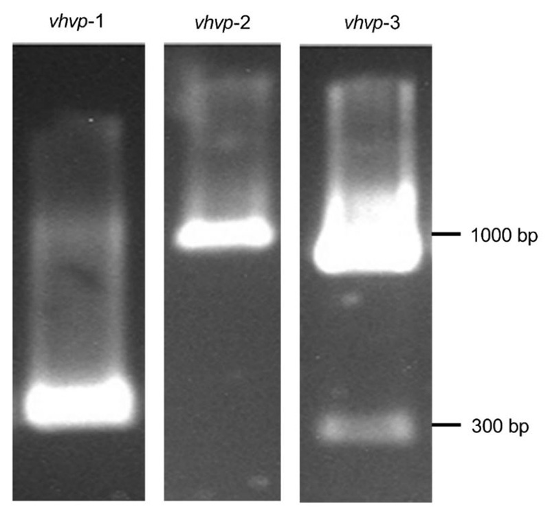 Xét nghiệm PCR của mầm bệnh TPD Xét nghiệm PCR của mầm bệnh TPD