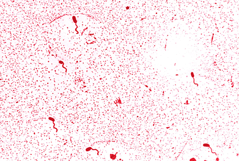 Hình thái vi khuẩn Vibrio harveyi Hình thái vi khuẩn Vibrio harveyi