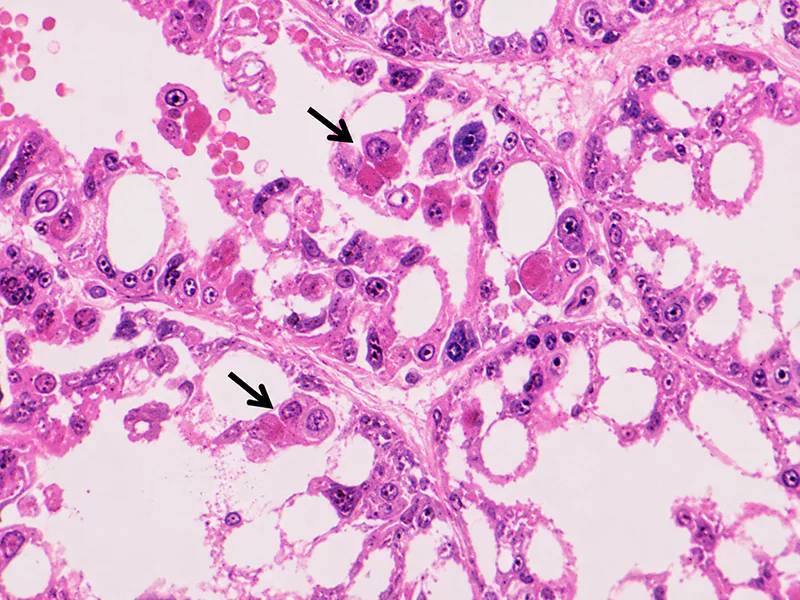 Virus Monodon Baculovirus