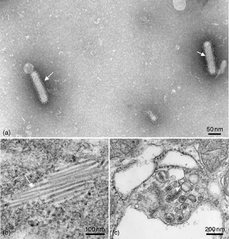 Virus YHV Virus YHV