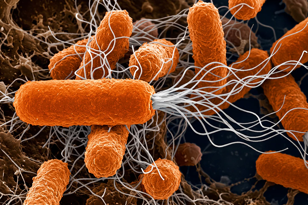 Khuẩn Pseudomonas Khuẩn Pseudomonas
