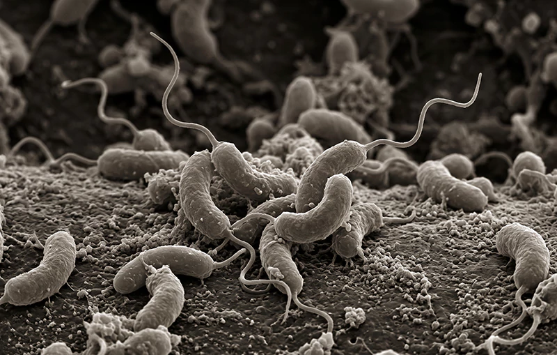 Vi khuẩn Vibrio alginolyticus Vi khuẩn Vibrio alginolyticus