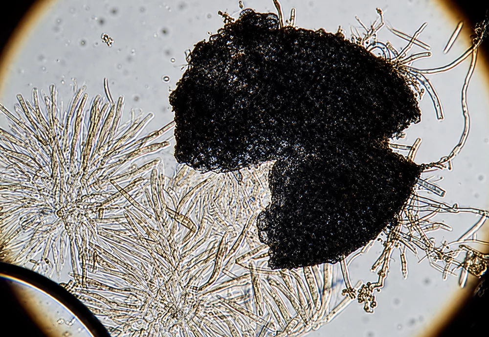 Nấm bậc cao Fusarium